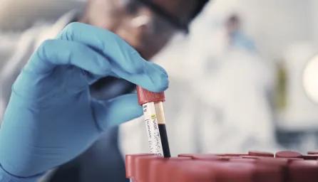 Scientist preparing biological samples