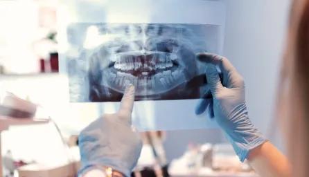 Dentists looking at x-ray image of teeth
