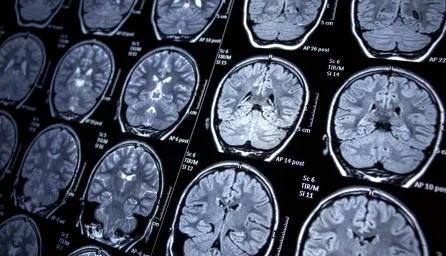 Multiple brain scan images