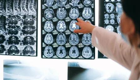 Close-up photo of MRI result