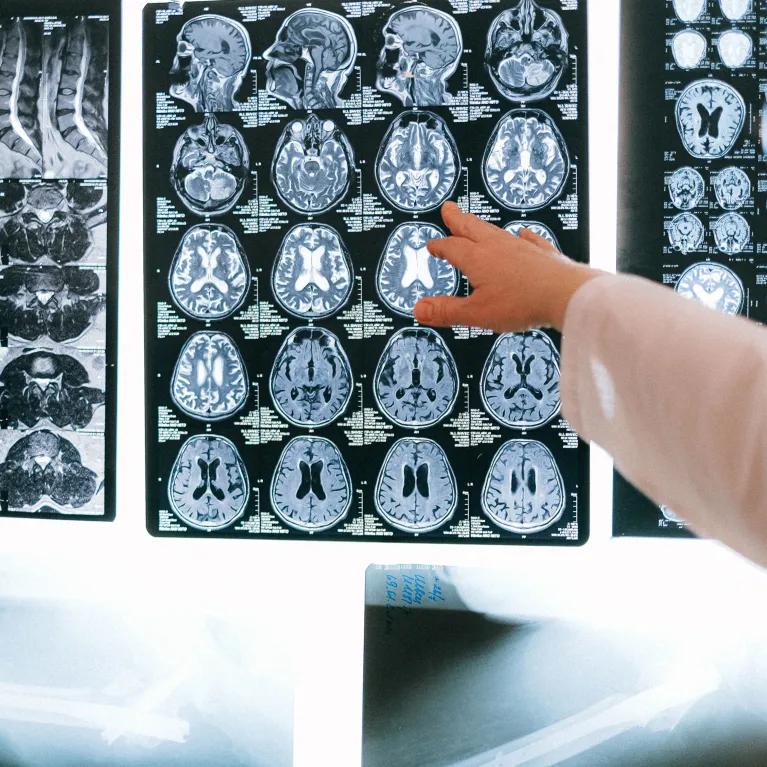 Close-up photo of MRI result